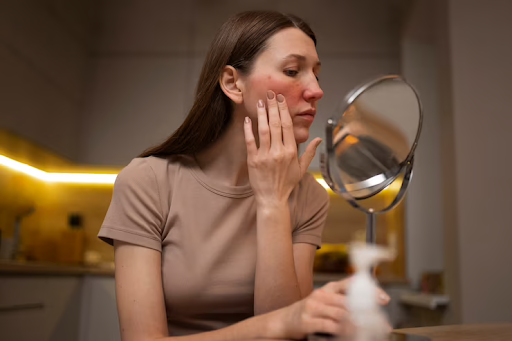 Unmasking Laser Acne Treatment: Busting Myths and Spilling Facts