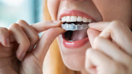 How Mouth Guards Can Help Prevent Jaw Pain and Headaches