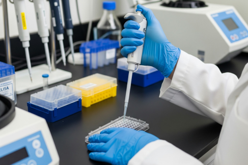 How ELISA Kits Help in Early Detection of Atherosclerosis