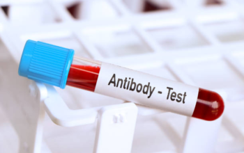 What Is IS200 ADH1A and How Is It Measured in Research