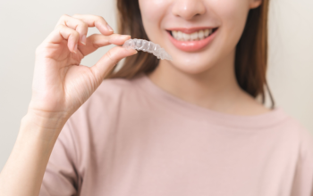 8 Benefits of Self-Ligating Braces For A Healthier Smile